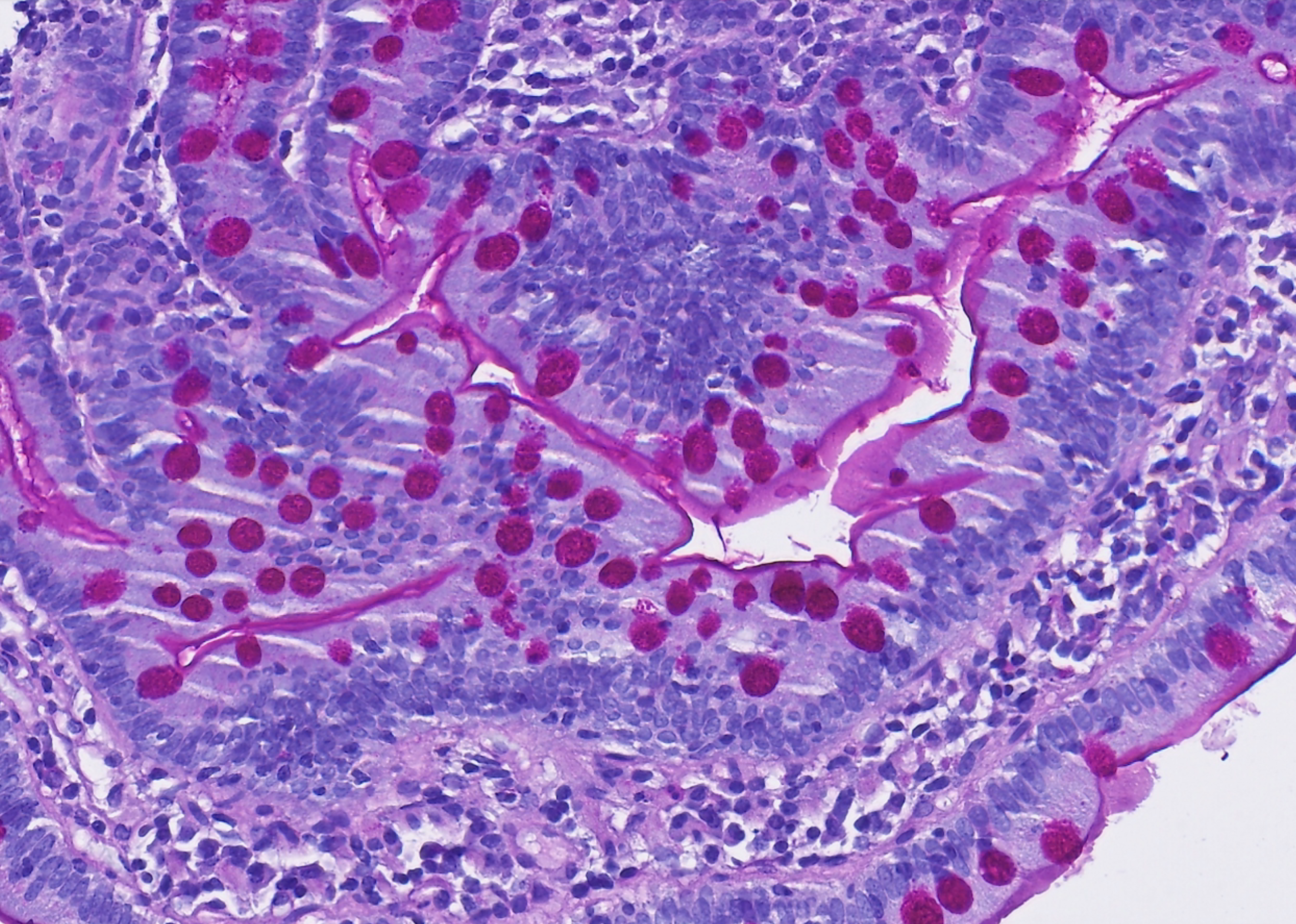 Intestinal mucosa thumbnail